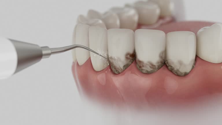 Trusted Invisalign Clear Aligners service in North Kensington, MD - Dentist Open Now